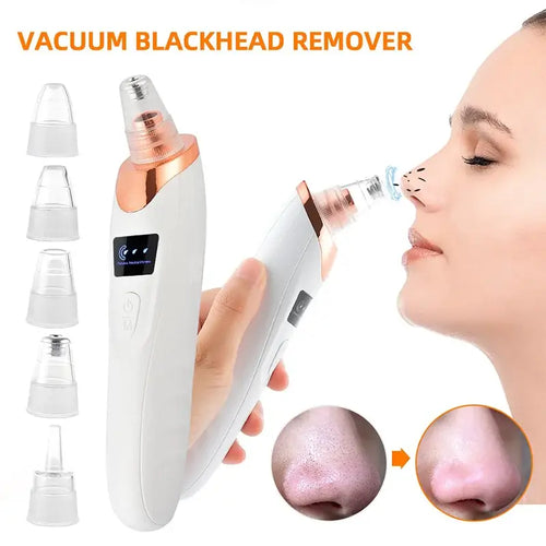 5-in-1 Rechargeable Vacuum Blackhead Remover