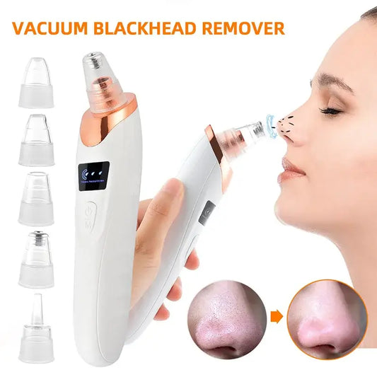 5-in-1 Rechargeable Vacuum Blackhead Remover