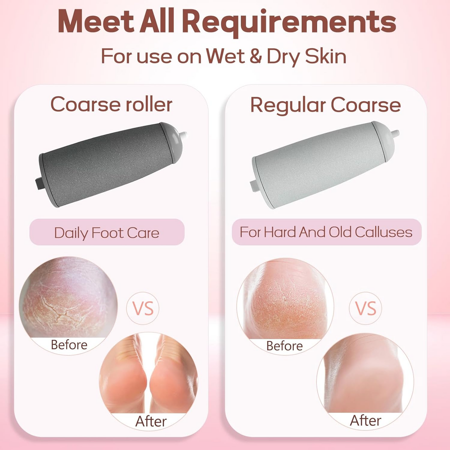 Professional Electric Callus Remover – Smooth & Soft Feet at Home