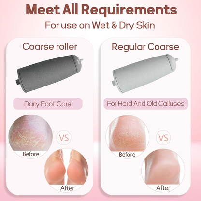 Professional Electric Callus Remover – Smooth & Soft Feet at Home