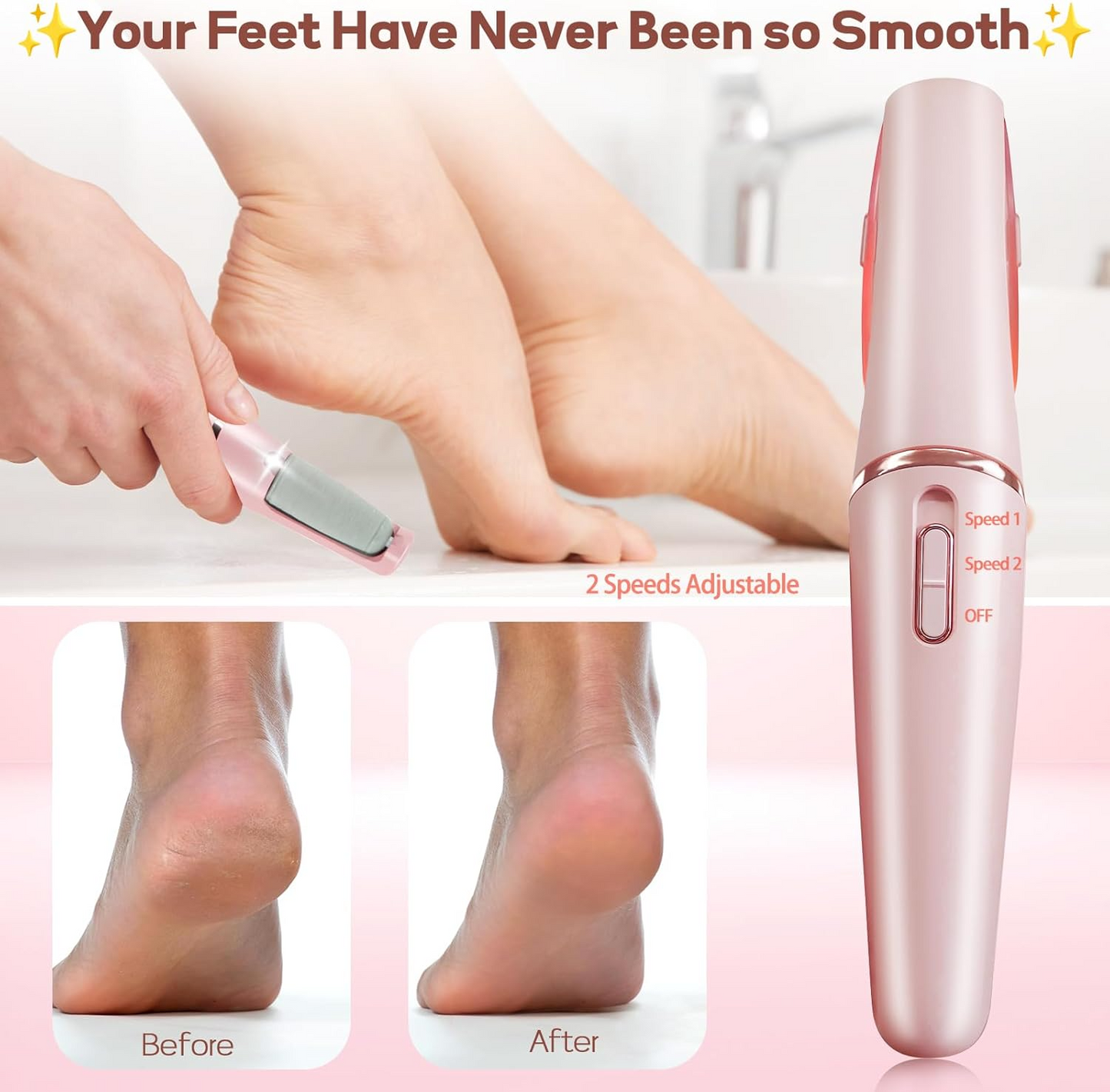 Professional Electric Callus Remover – Smooth & Soft Feet at Home