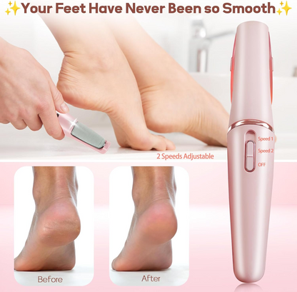 Professional Electric Callus Remover – Smooth & Soft Feet at Home